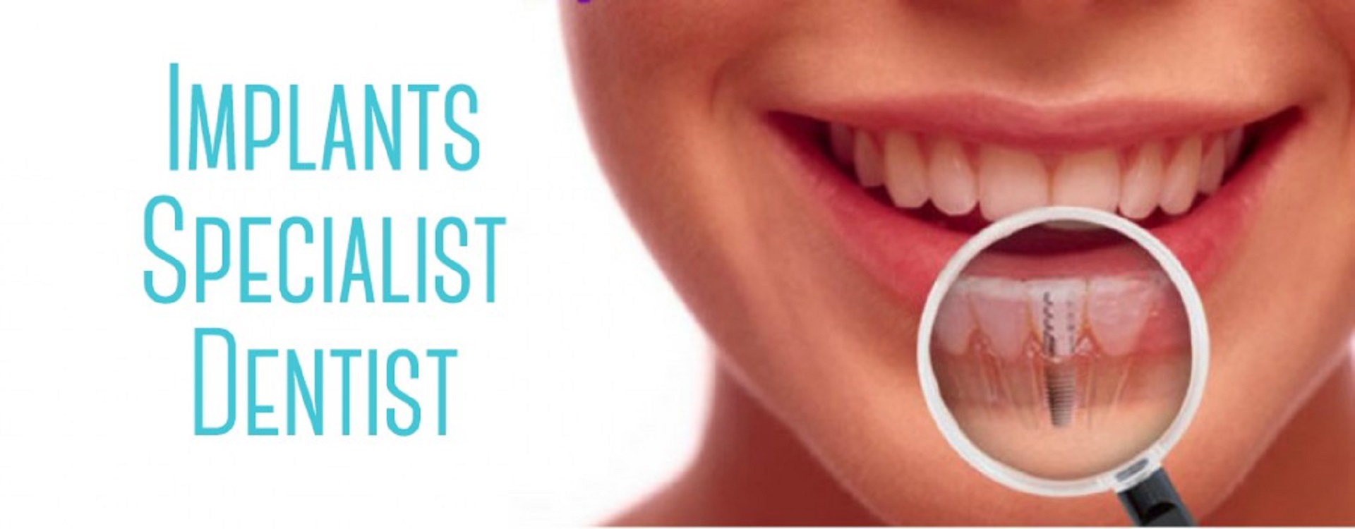 Zâmbet cu implant dentar văzut prin lupă